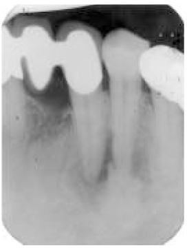 jkacd-30-66-g001.jpg
