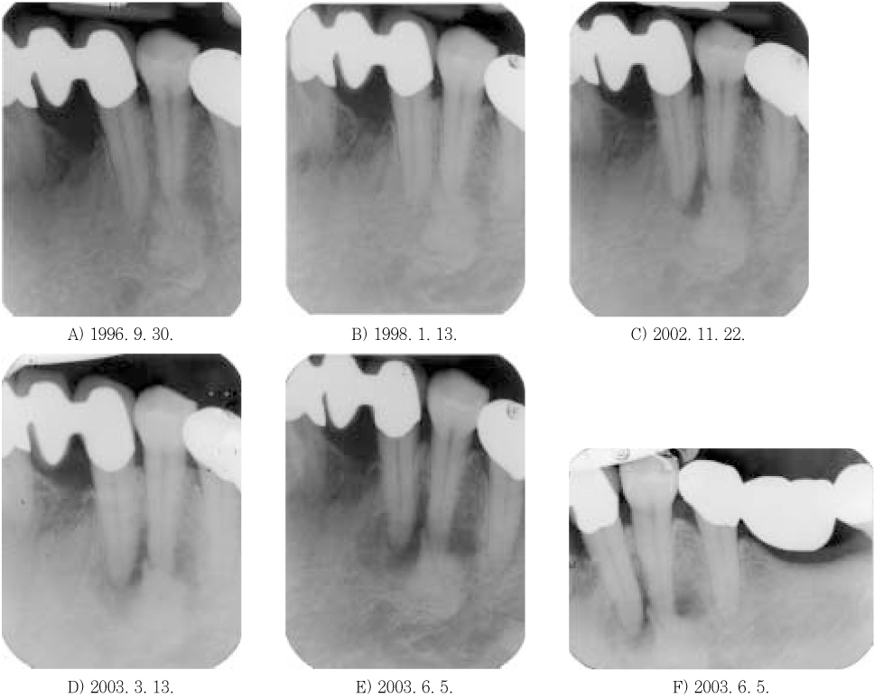 jkacd-30-66-g002.jpg