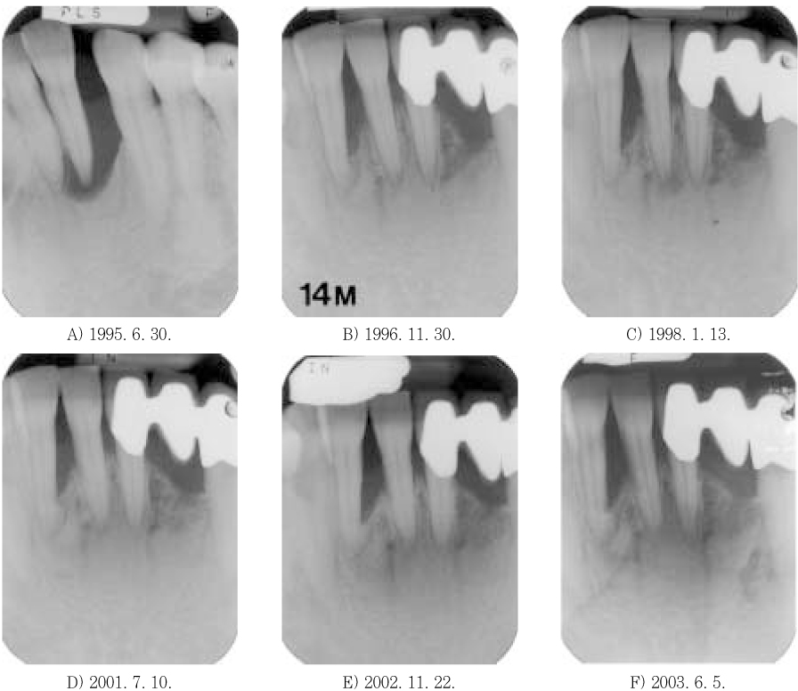 jkacd-30-66-g004.jpg