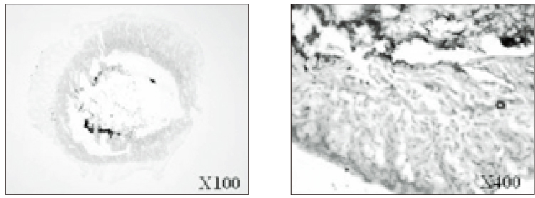 jkacd-31-398-g009.jpg
