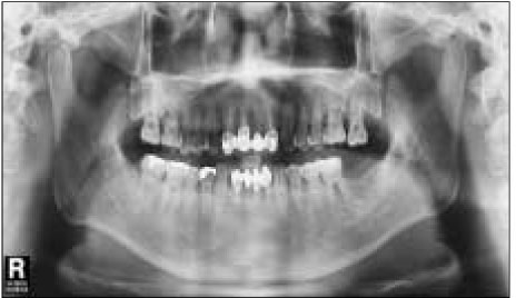 jkacd-33-452-g002.jpg