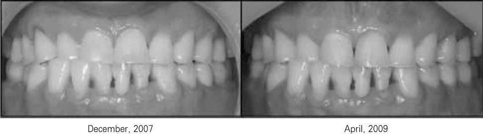 jkacd-35-20-g005.jpg
