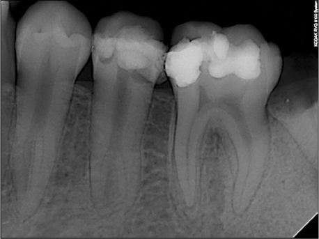 jkacd-35-302-g001.jpg