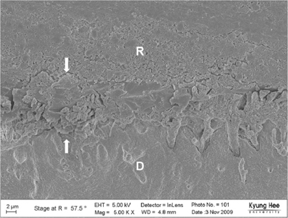 jkacd-35-321-g011.jpg