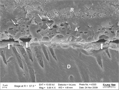 jkacd-35-321-g020.jpg