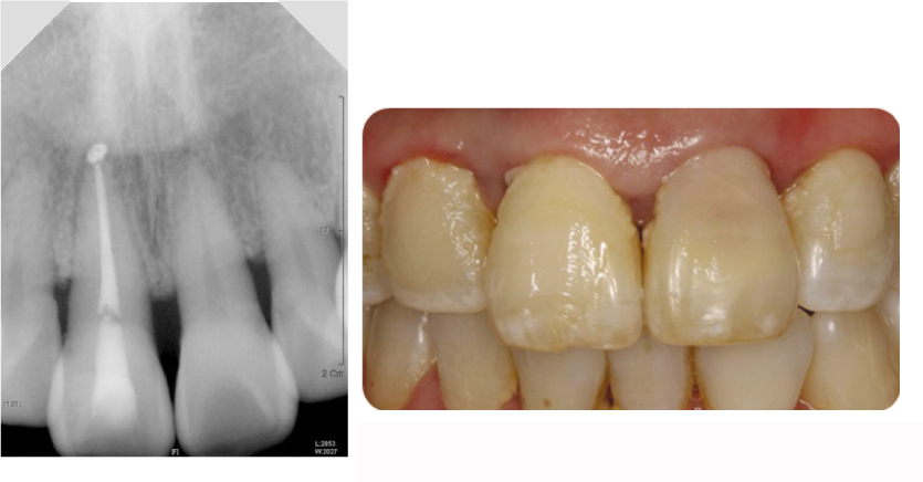 jkacd-35-492-g002.jpg
