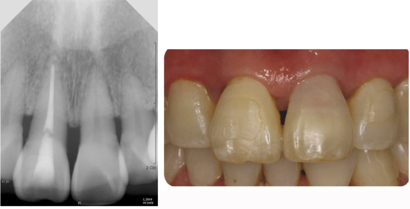 jkacd-35-492-g003.jpg
