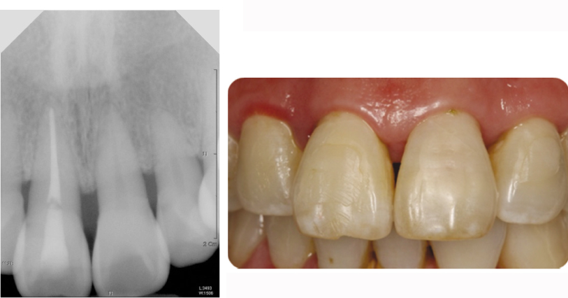 jkacd-35-492-g005.jpg