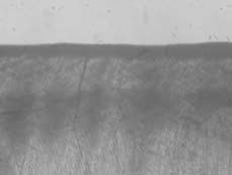 jkacd-35-96-g003.jpg