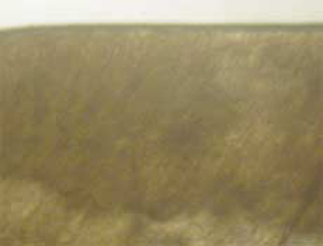jkacd-35-96-g008.jpg