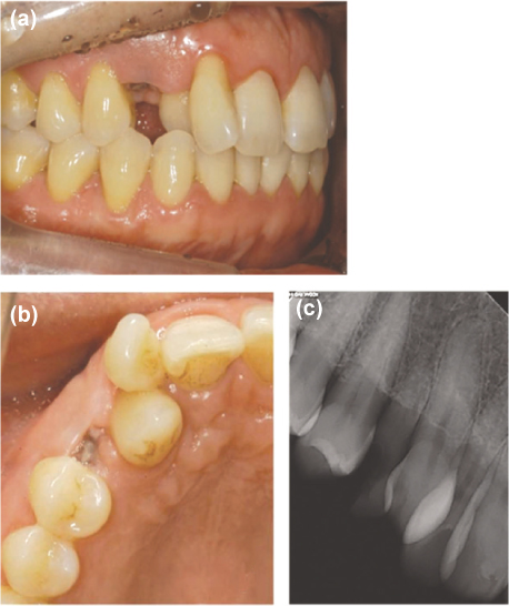 jkacd-36-336-g001.jpg