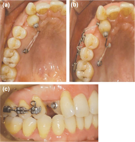 jkacd-36-336-g002.jpg