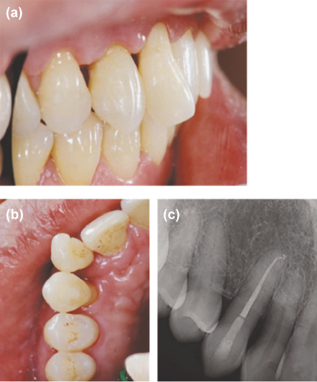 jkacd-36-336-g004.jpg