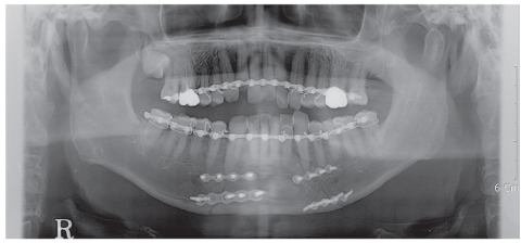 rde-37-110-g002.jpg