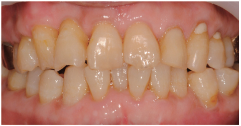 rde-37-110-g008.jpg