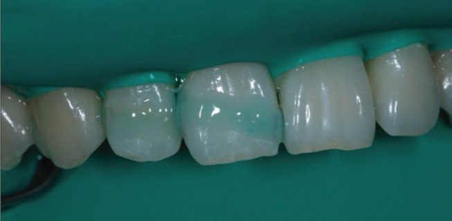 rde-37-240-g006.jpg