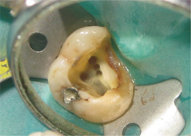 rde-38-172-g001.jpg