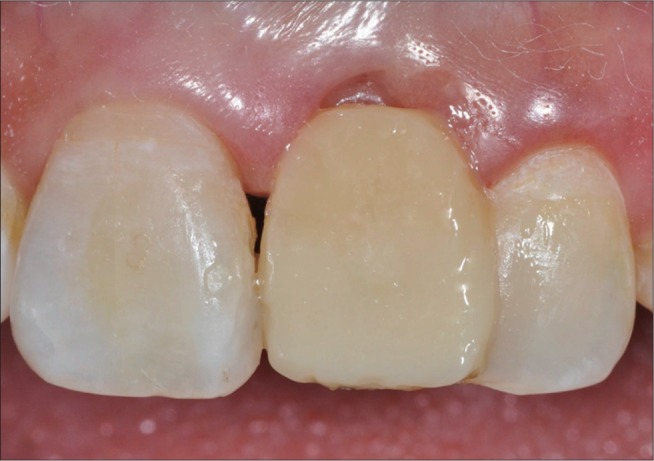 rde-39-220-g010.jpg