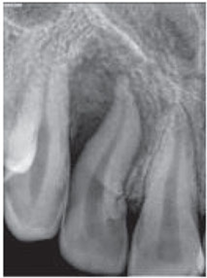 rde-40-314-g003.jpg