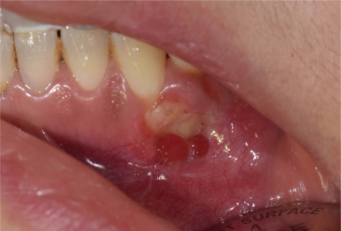 rde-41-332-g004.jpg