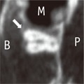 rde-41-55-i010.jpg